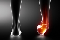 The Three Grades of Ankle Sprains