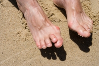 What is Hammertoe and Mallet Toe?