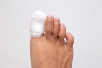 Is My Stubbed Toe Serious?