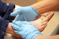 How to Keep Feet Healthy If You Have Diabetes